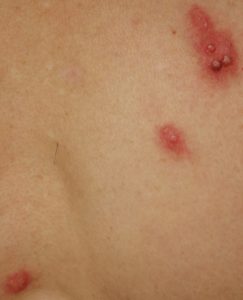 0930-10